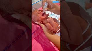 How To Give Pulse Polionewbornbaby viralvideo [upl. by Sidnal]