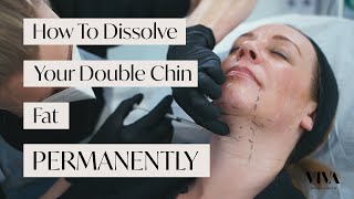 How to Dissolve your Double Chin Fat PERMANENTLY 😍 [upl. by Corrie586]