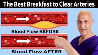 The Healthiest Breakfast to Clean and Open Arteries Prevent Heart Attack amp Stroke Dr Mandell [upl. by Onateag]