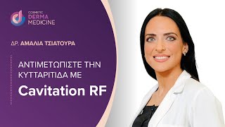 Αντιμετωπίστε την κυτταριτιδα με Cavitation RF [upl. by Nomannic]