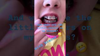 What are the colors on my braces 😬 ￼ [upl. by Buckley]