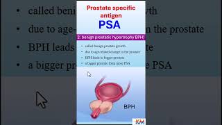 Why is a PSA level elevated psa prostateproblems prostatecancer [upl. by Mufinella]