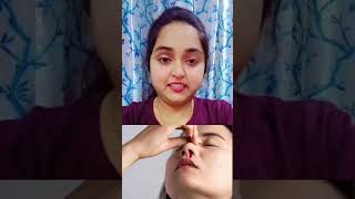 Epistaxis amp Its Homoeopathic medicineshorts short epistaxis shortvideo nosebleeding health [upl. by Rehm76]