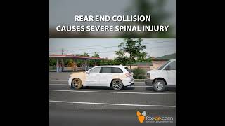 Rear End Collision Causes Severe Spinal Injury [upl. by Ehud]