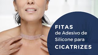 Fita de Silicone para Cicatriz Supérbia  TRATAMENTO PARA CICATRIZES indolor e não invasivo [upl. by Rosanna51]