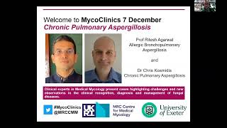 MycoClinics S3E2 Chronic Aspergillosis [upl. by Nairadal]