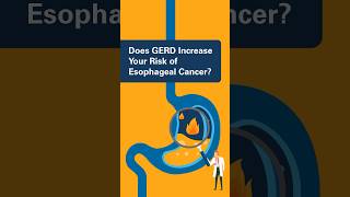 Does GERD Increase Your Risk of Esophageal Cancer [upl. by Annahsad]