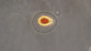 Haematococcus pluvialis the green algae that turn red [upl. by Adnolahs]