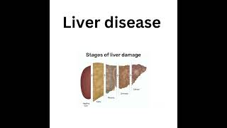 Bleeding Gums These Diseases Could Be the Cause [upl. by Chobot]