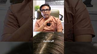 How to Treat Dandruff correctly  Dandruff Removal Tips by Dermatologist dandruff dandruffcontrol [upl. by Aisul]