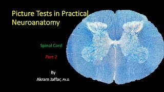 Picture Test in Neuroanatomy Spinal Cord 2 [upl. by Maxa]