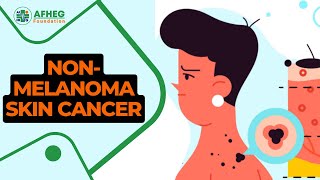 Understanding NonMelanoma Skin Cancer Causes Symptoms and Treatment Options [upl. by Alo]