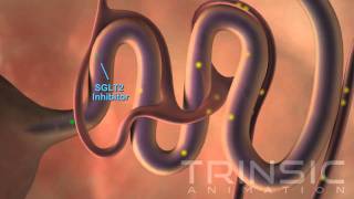 Diabetic Kidney Medical Animation [upl. by Akinar991]