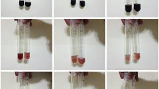 Alpha amylase colour development in assay determination [upl. by Louth]