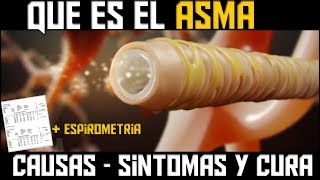 QUE ES EL ASMA ANIMACION  CAUSAS SINTOMAS Y TRATAMIENTO [upl. by Antoinette500]