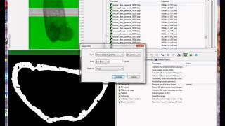 Cortical bone 1 periosteal and endosteal parameters [upl. by Adnilasor640]