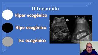 terminología básica en imágenes rx usg ct y mri [upl. by Merilyn245]