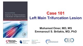 Case 101 PCI Manual  Left main trifurcation [upl. by Greenwald]