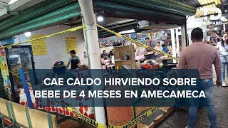 Cazuela hirviendo cae sobre bebé de 4 meses y le deja quemaduras severas en Amecameca [upl. by Cormac]