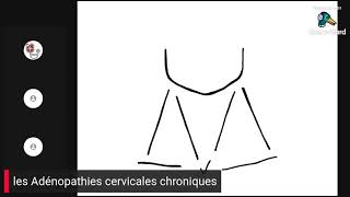 Les adénopathies cervicales chroniques [upl. by Folger]