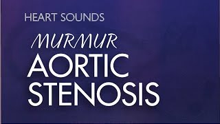 Aortic Stenosis Murmur  With Murmur Sounds Audio Mrrmurs Made Easy [upl. by Trstram]