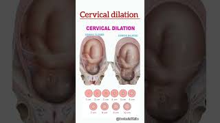 Cervical dilation  viralshorts cervix cervical dilation obgy [upl. by Annissa]