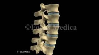 Fracture and dislocation of the vertebrae  Back and Spinal Cord [upl. by Rachael458]