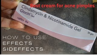 best cream for acne pimplesglocin gelremove pimple in 34 daystrending pharmacy viral skincare [upl. by Miranda]