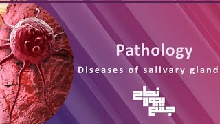 Diseases of salivary glands Pathology L1 [upl. by Annaor]