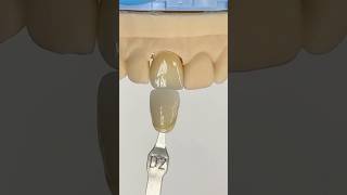 Another Perfectly Shaded Incisor EnvisiontecMain envisiontec lsk121shorts dentist [upl. by Jody]