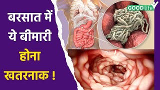 Amoebiasis Disease क्या है  Symptoms Reason और कैसे लें Precautions  Amoebasis Kya Hai Good Life [upl. by Yahsan]