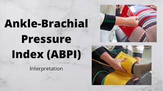 Ankle  Brachial Pressure Index ABPI Interpretation  Dr Muhammad [upl. by Renba587]