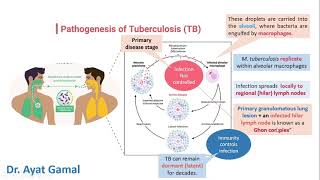 General signs amp symptoms of TB In brief for dentists [upl. by Magan]