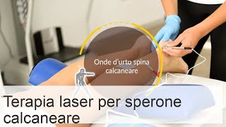 Trattamento speroni calcaneali con laser recensioni corso e controindicazioni [upl. by Maupin]