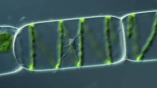 The Nucleus of Spirogyra Synedra [upl. by Gleda]