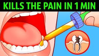 10 Ways to Kill a Toothache In a Minute [upl. by Zaneta]