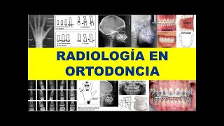 quotRADIOLOGÍA EN ORTODONCIA BASADA EN EVIDENCIASquot [upl. by Berny]