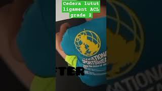 Cedera lutut ligament ACL grade 2 karena main futsal [upl. by Carlene]