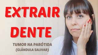 Extrair dente  tumor na parÃ³tida [upl. by Travis]