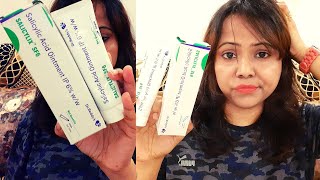 My 1 Month Experience  Salicylic Acid Ointment IP 6  SALICYLIX SF6 [upl. by Ecineg]