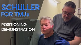 Schuller for TMJs Radiographic Positioning Demonstration [upl. by Gora]