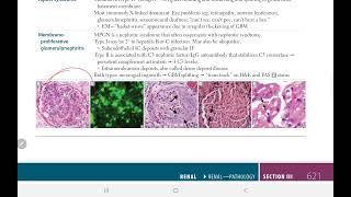 Acute Postsreptococcal Glomerulonephritis  BACK BENCHERS ACADEMY  First Aid USMLE Step 1 [upl. by Kat]