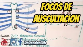 Focos de auscultación cardiaco facil y sencillo [upl. by Lukas]