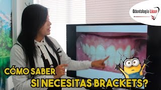 Cómo saber si necesitas brackets Tengo mala mordida [upl. by Ekaterina]