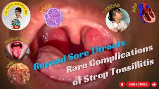 Beyond Sore Throats Rare Complications of Strep Tonsillitis [upl. by Oicatsana]