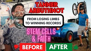 Stem cells amp faith how Tanner Arbuthnot Went From Losing a Limb To Winning World Records [upl. by Alam495]