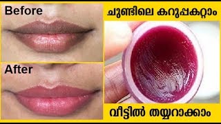 ചുണ്ടിലെ കറുപ്പ് മാറ്റം  വീണ്ടുകീറലും പോകും How to make Lip Balm at Home [upl. by Aicile]