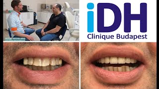 Refaire ses dents et retrouver un beau sourire – Dr Szrebro Dentiste Hongrie Budapest iDH clinique [upl. by Edelsten]