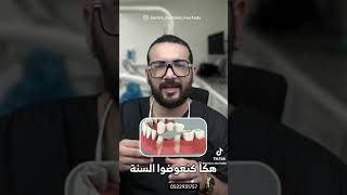 Appareil dentaire dentist choftv dentalclinic chouf casablanca botox shortvideo doctor [upl. by Delphine]