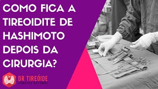 Como fica a Tireoidite de Hashimoto após a tireoidectomia [upl. by Wales]